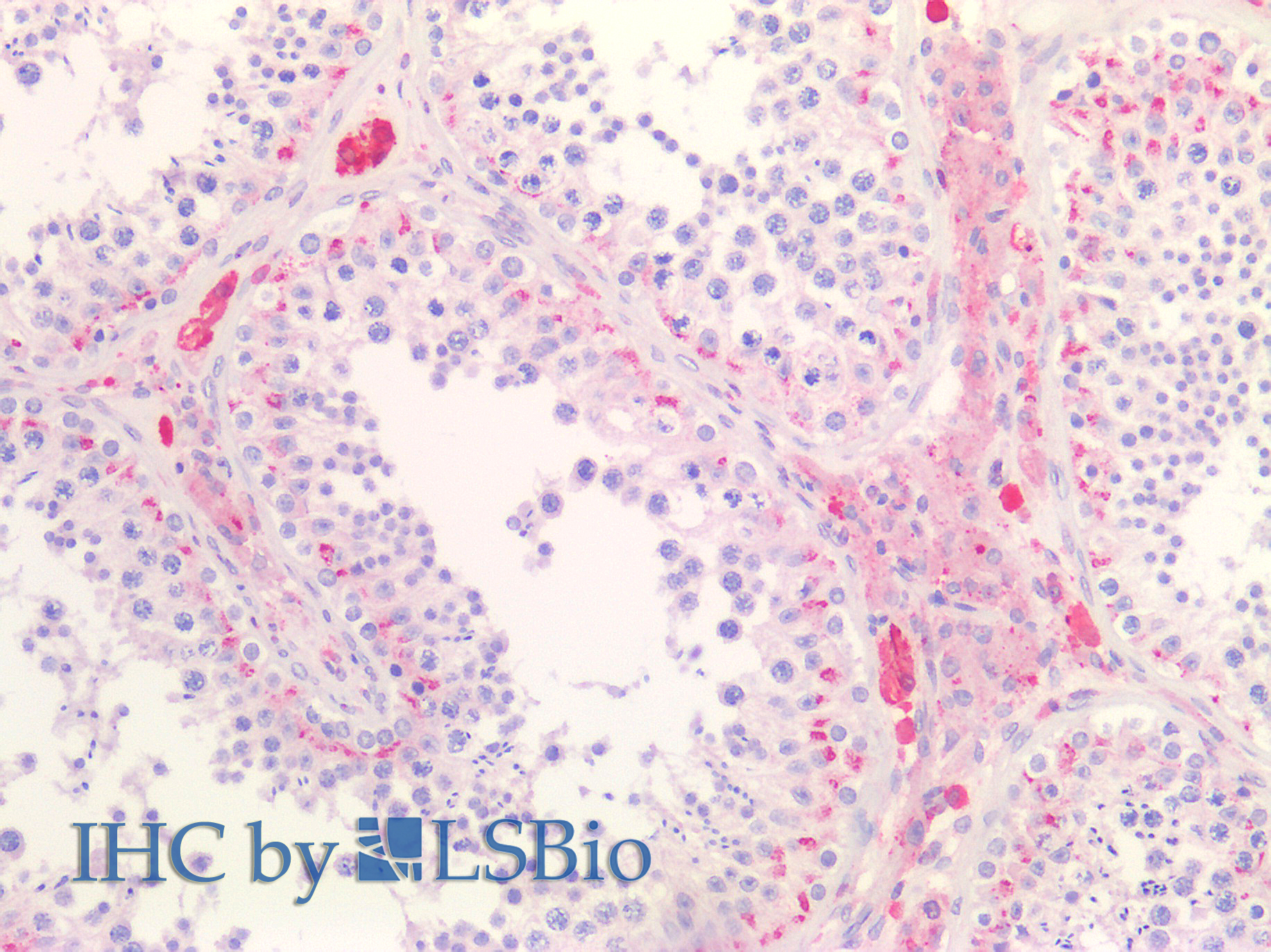 Goat Anti-SCARB1 / SR-BI Antibody