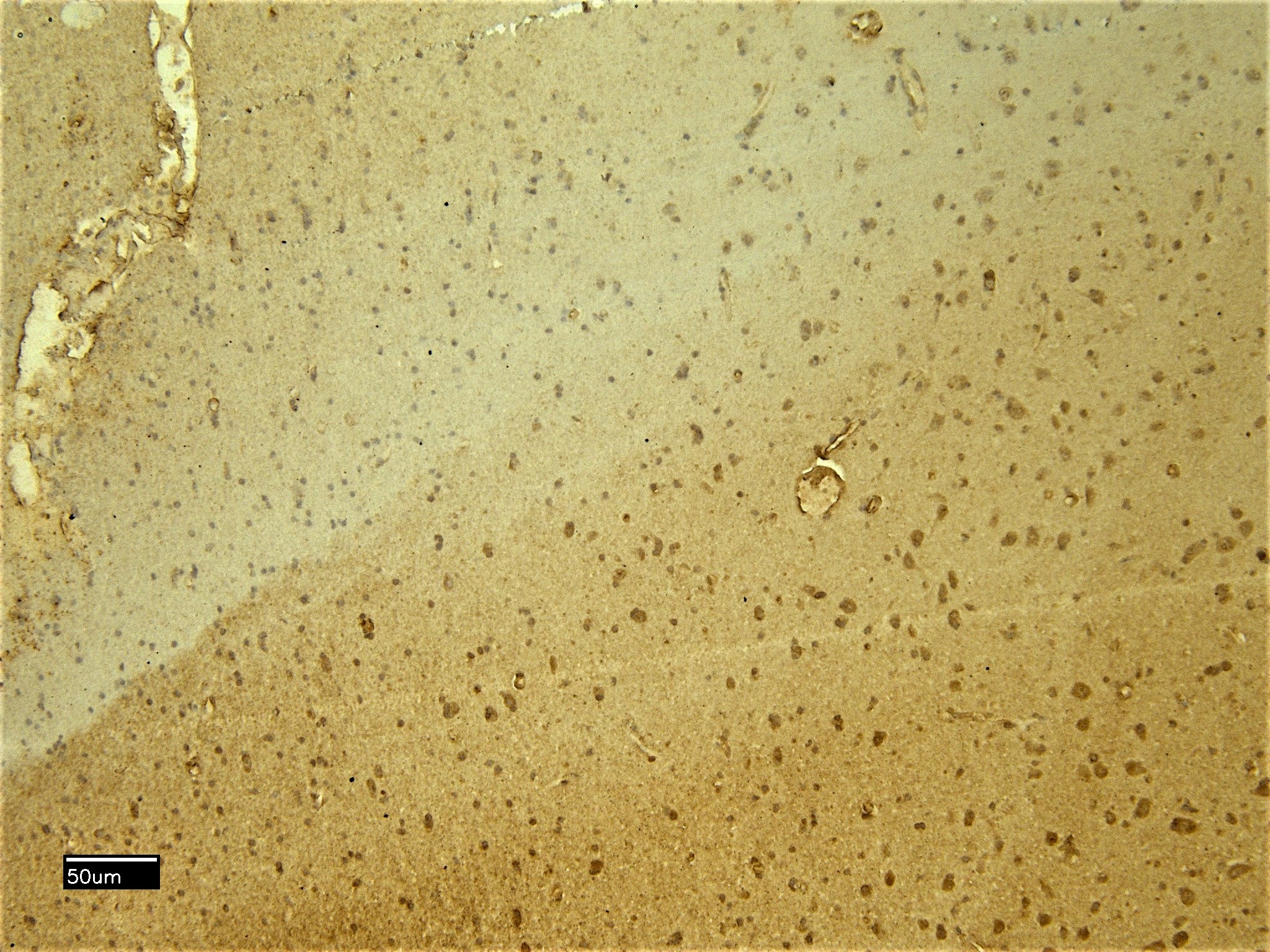 Goat Anti-SCN5A Antibody