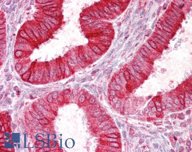 Goat Anti-SCNN1D Antibody