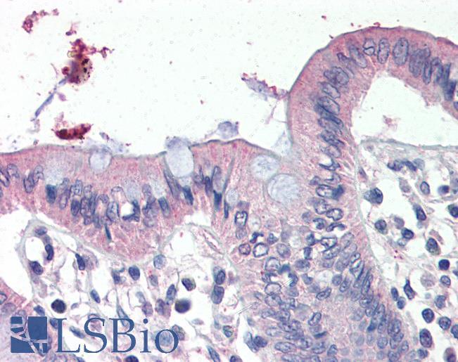 Goat Anti-SCNN1G  Antibody