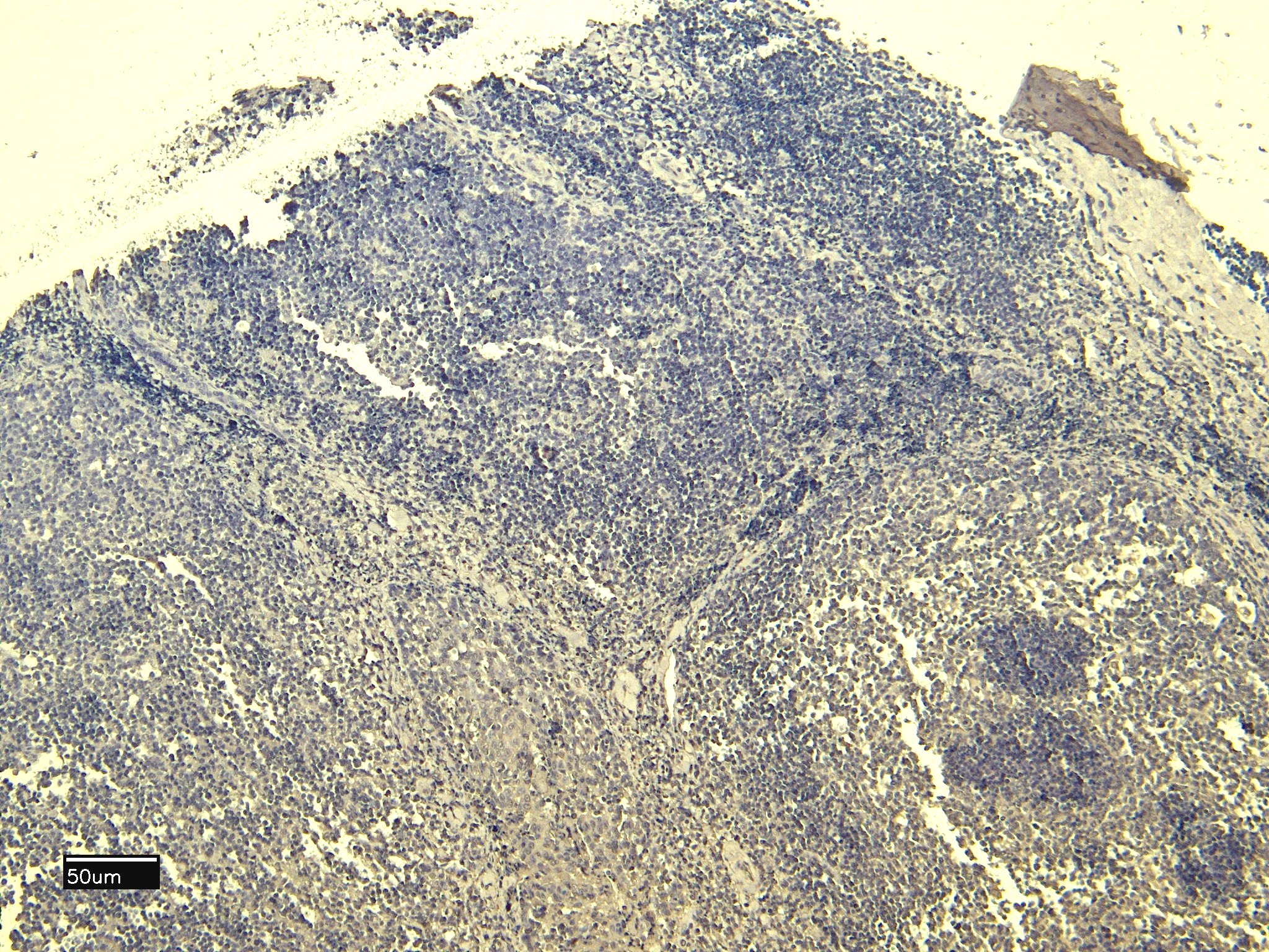 Goat Anti-Scribble / Vartul Antibody