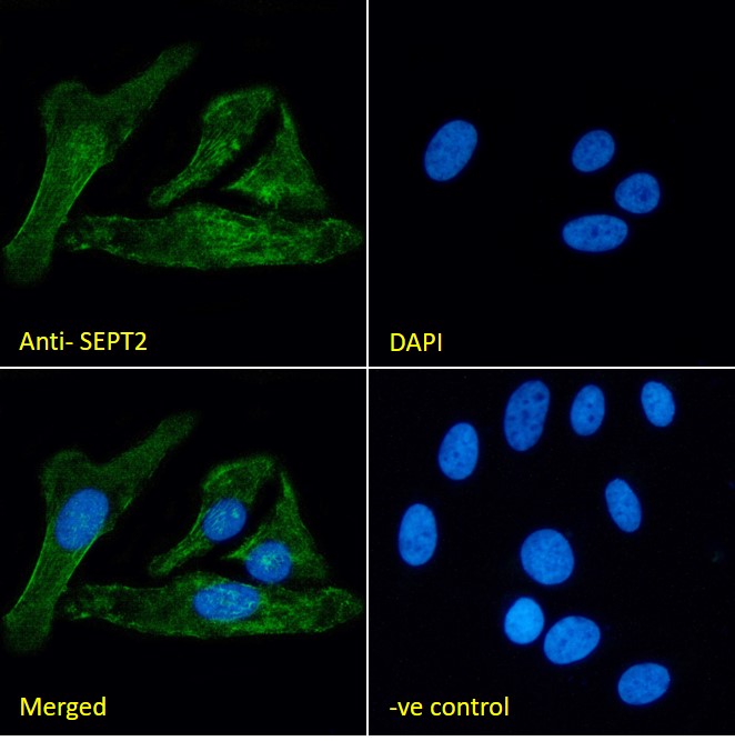 Goat Anti-SEPT2 Antibody