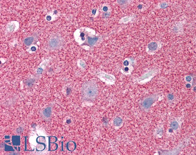 Goat Anti-Septin 3 Antibody