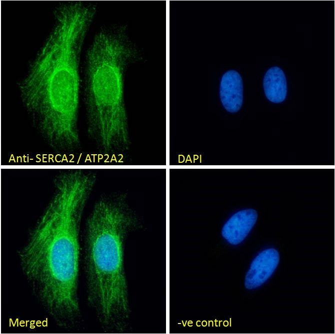 Goat Anti-SERCA2 / ATP2A2 Antibody