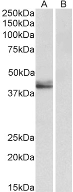 Goat Anti-SERPINB1 (aa130-143) Antibody