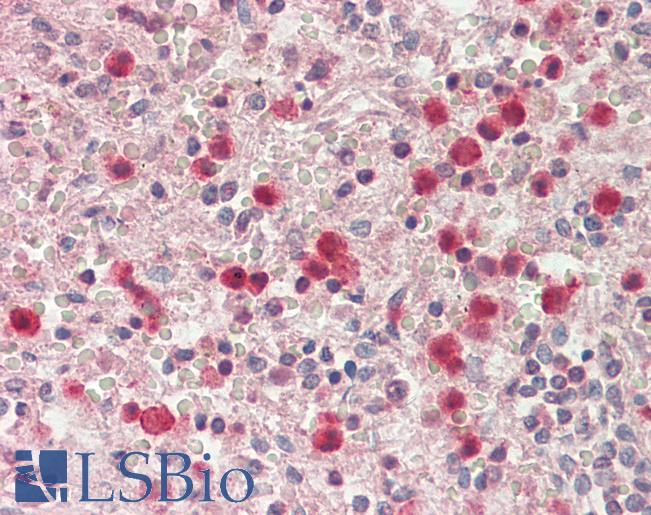 Goat Anti-SERPINB1 Antibody