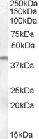 Goat Anti-SERPINB6 Antibody