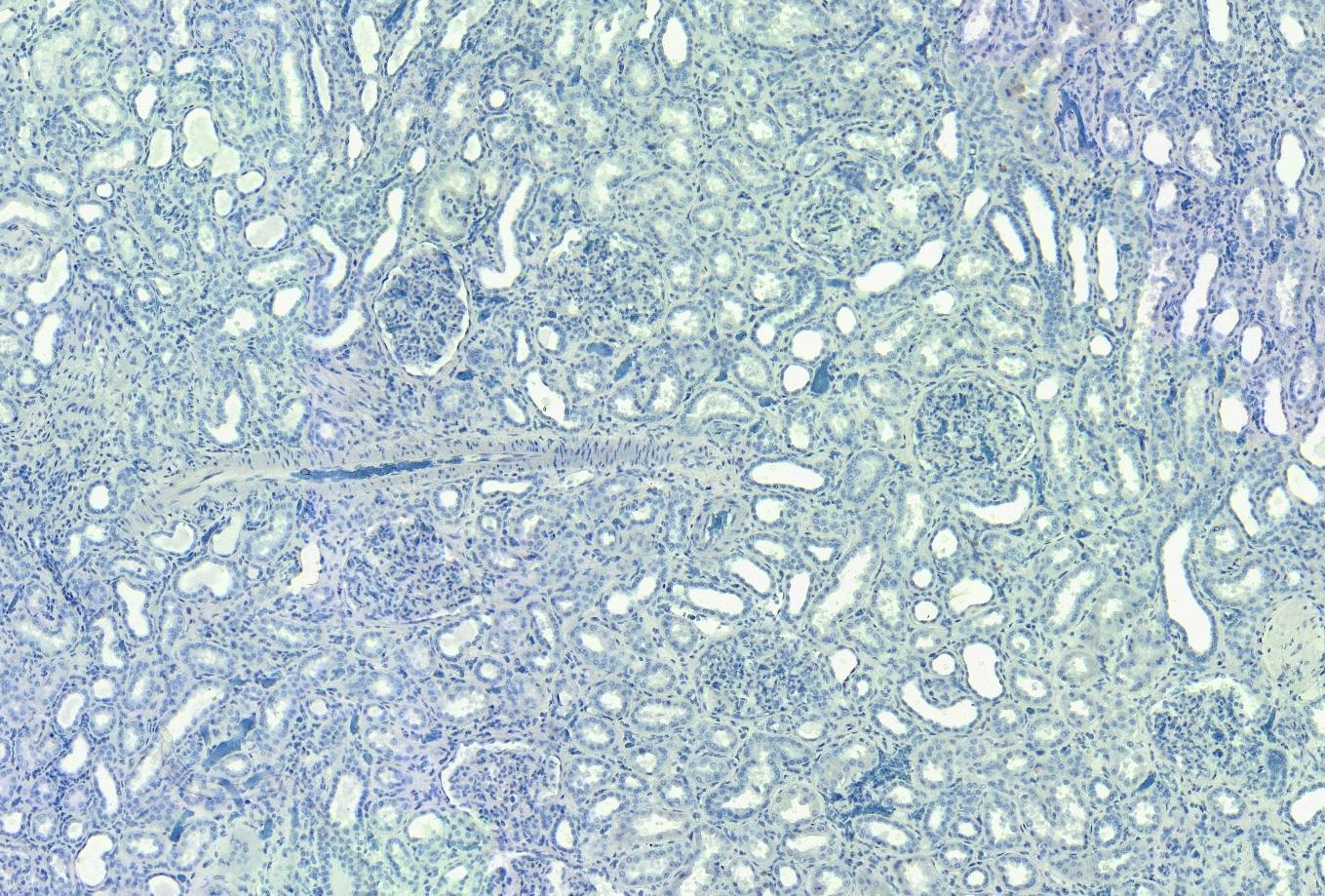 Goat Anti-SET / I2 alpha PP2A Antibody