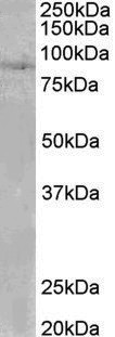 Goat Anti-SETDB2 Antibody