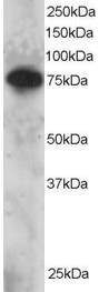 Goat Anti-SETMAR Antibody