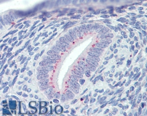 Goat Anti-SFRP1 / FRP1 Antibody