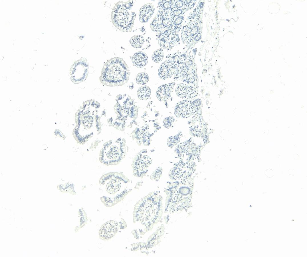 Goat Anti-SGLT1 Antibody