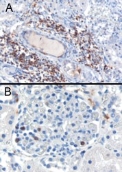 Goat Anti-SH3BP1 Antibody