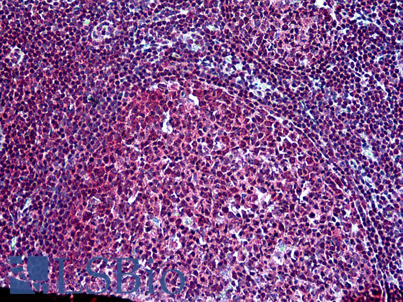 Goat Anti-SH3KBP1 (N Terminus) Antibody