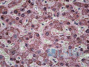 Goat Anti-SH3PXD2A Antibody