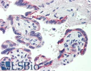 Goat Anti-SHBG Antibody