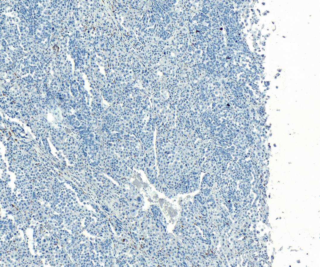 Goat Anti-Silver homologue / Pmel 17 (C-terminus) Antibody