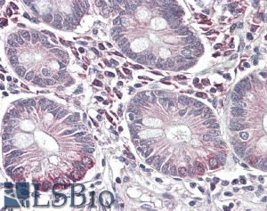 Goat Anti-SLC10A2 / ASBT Antibody