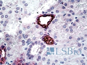 Goat Anti-SLC12A1 / NKCC Antibody