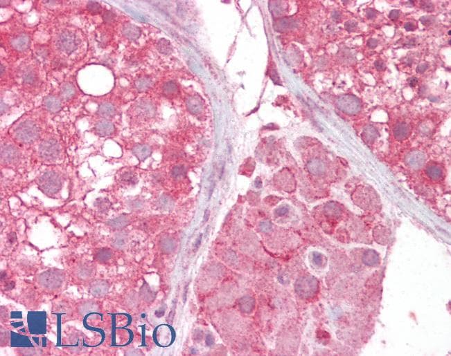 Goat Anti-SLC16A7 / MCT2 Antibody