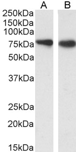 Goat Anti-SLC26A6 Antibody