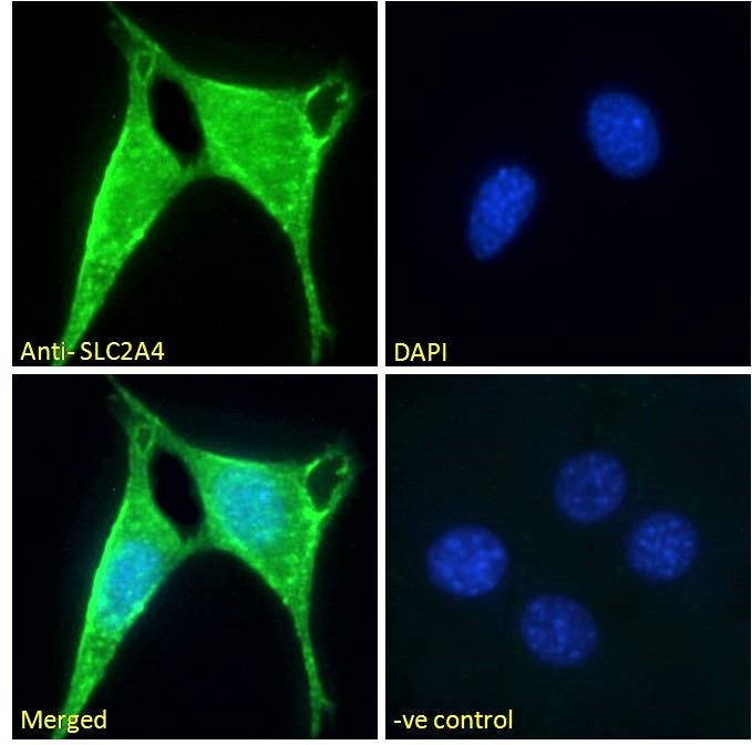 Goat Anti-SLC2A4 Antibody