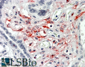 Goat Anti-SLC46A1 / PCFT Antibody