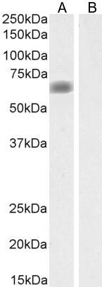 Goat Anti-SLC47A1 Antibody