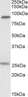 Goat Anti-SLC4A11 / BTR1 Antibody
