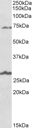 Goat Anti-SLC6A12 / BGT1 Antibody