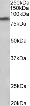 Goat Anti-SLC6A3 / DAT Antibody