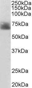 Goat Anti-SLC6A4 / 5HTT / SERT Antibody