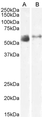 Goat Anti-SLC7A7 / y+LAT-1 Antibody