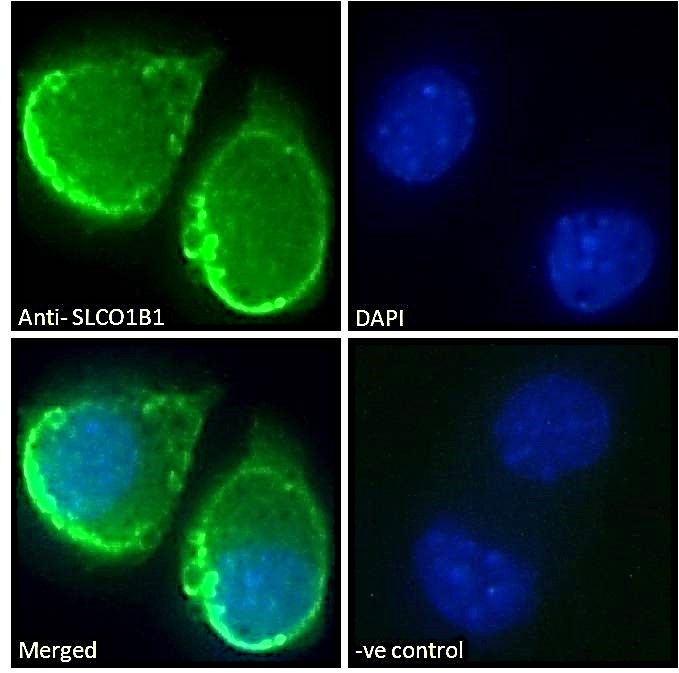 Goat Anti-SLCO1B1 Antibody
