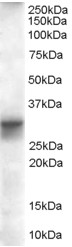 Goat Anti-SLIMMER / FHL1 isoform B Antibody