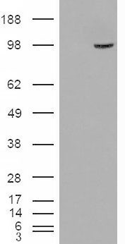 Goat Anti-SMEK1 / KIAA2010 Antibody