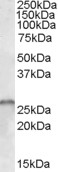 Goat Anti-SMN1 / SMN2 Antibody