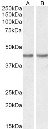 Goat Anti-Smooth muscle alpha-actin Antibody