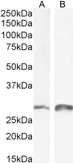 Goat Anti-Snail homolog 1 / SNAI1 Antibody