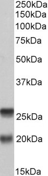 Goat Anti-SNAP23 (aa 135-144) Antibody