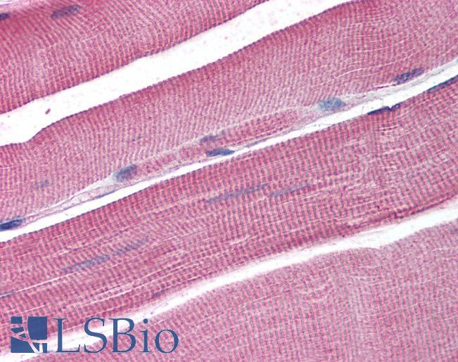 Goat Anti-SNM1 / DCLRE1A (internal) Antibody