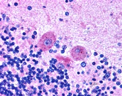 Goat Anti-SNX26 / TCGAP (C Terminus) Antibody