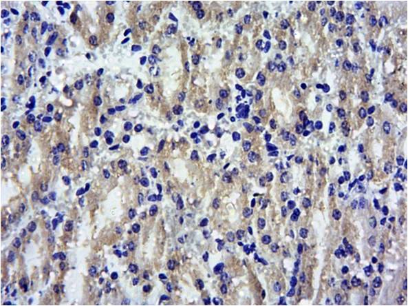 Goat Anti-SOCS1 Antibody