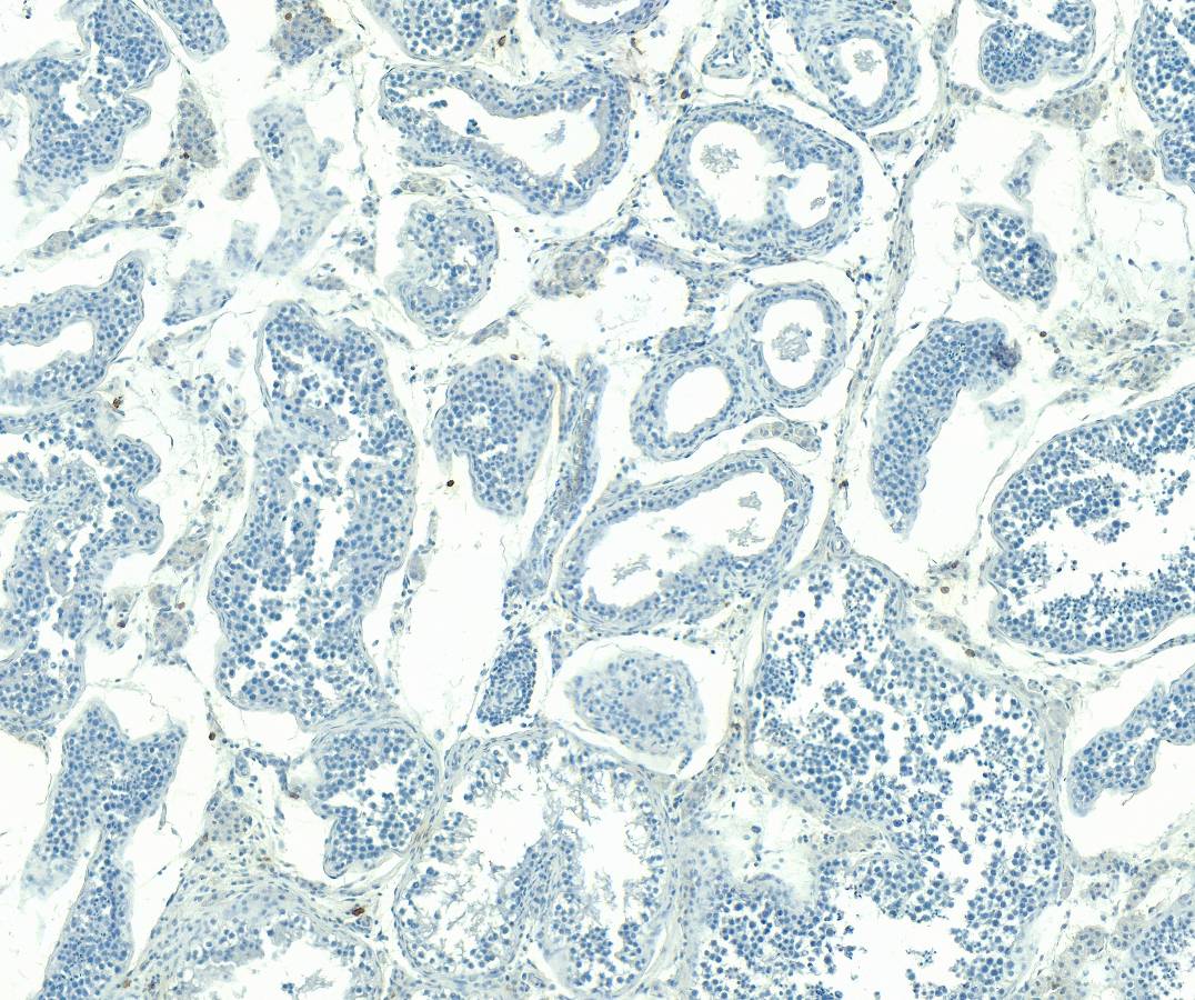 Goat Anti-SOCS2 Antibody