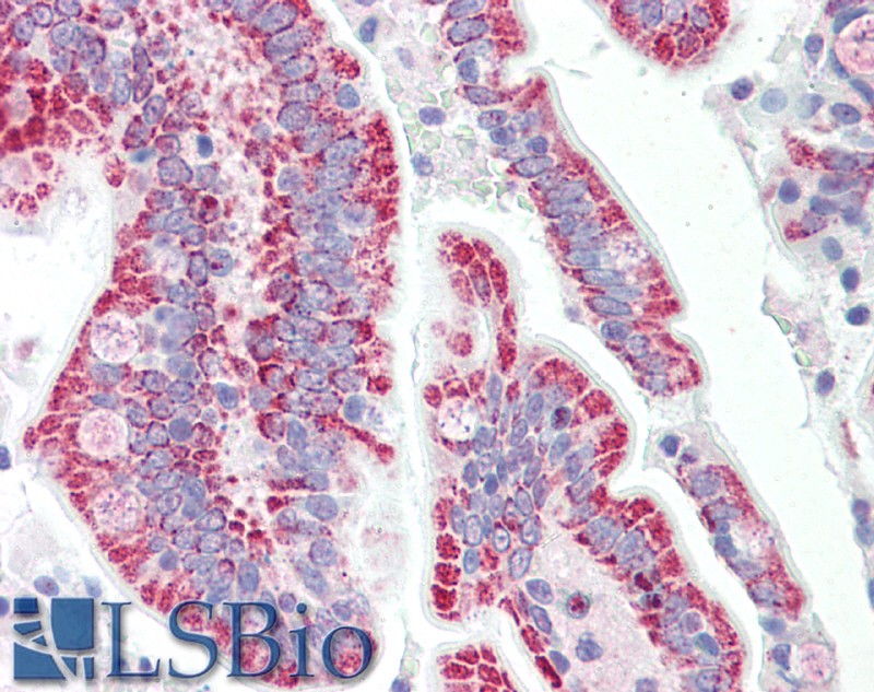 Goat Anti-SON Antibody