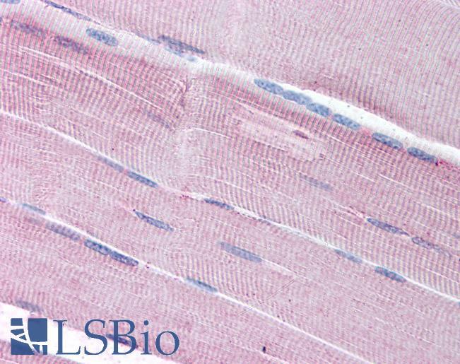 Goat Anti-SORBS1 / ponsin (internal) Antibody