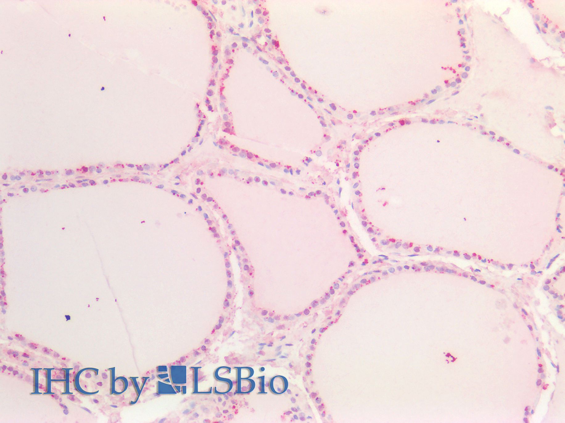 Goat Anti-Sox9b (zebrafish aa5-18) Antibody