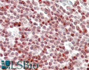 Goat Anti-SP110 Antibody