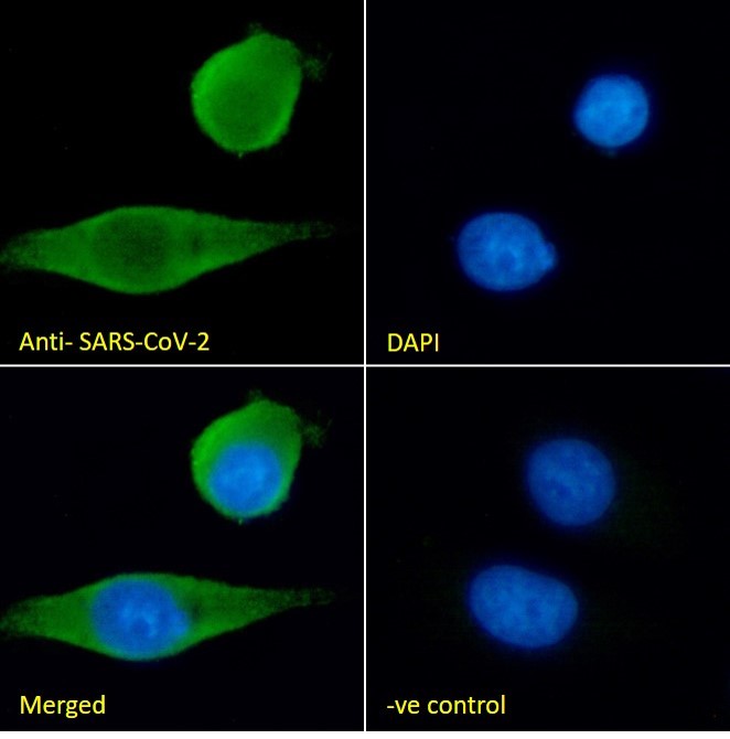 Goat Anti-SARS-COV2 Spike protein- S1 Domain (N Terminal) Antibody