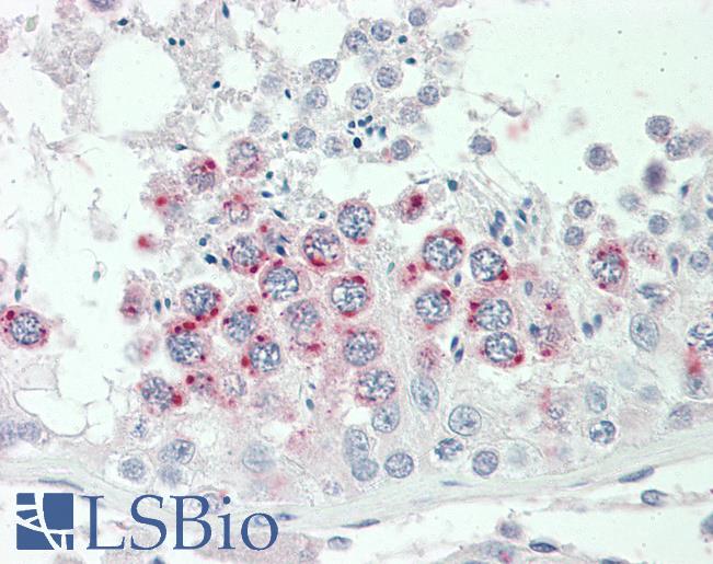 Goat Anti-SPINT2 Antibody